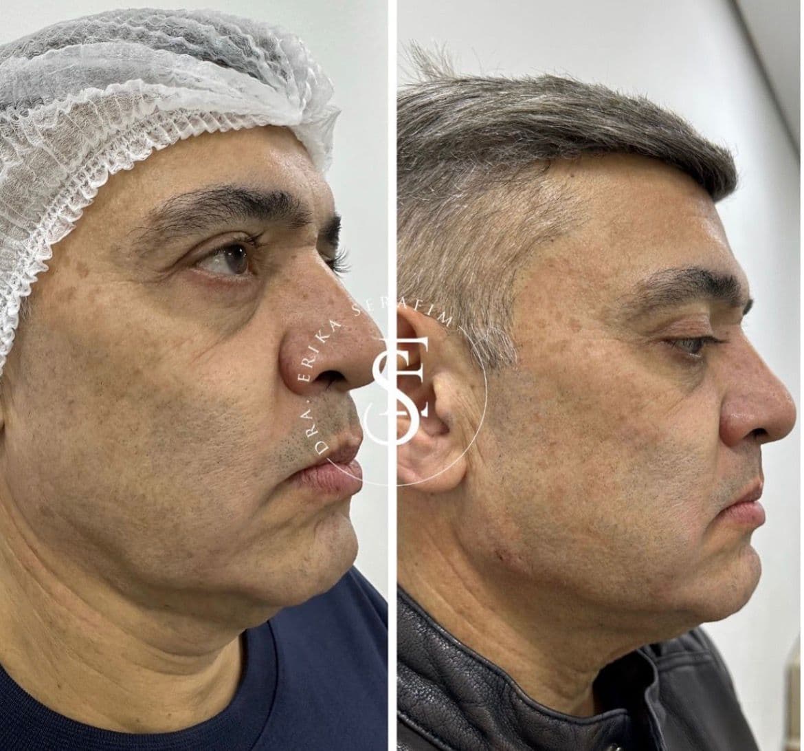 Resultado 12 — Antes e Depois