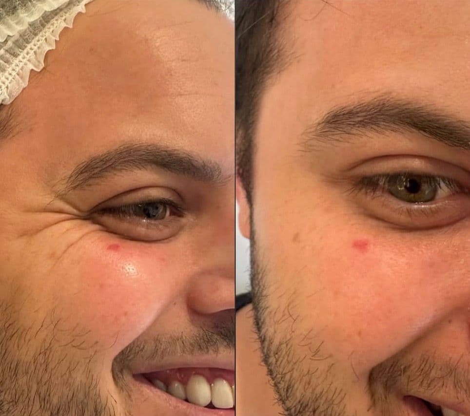Resultado 5 — Antes e Depois