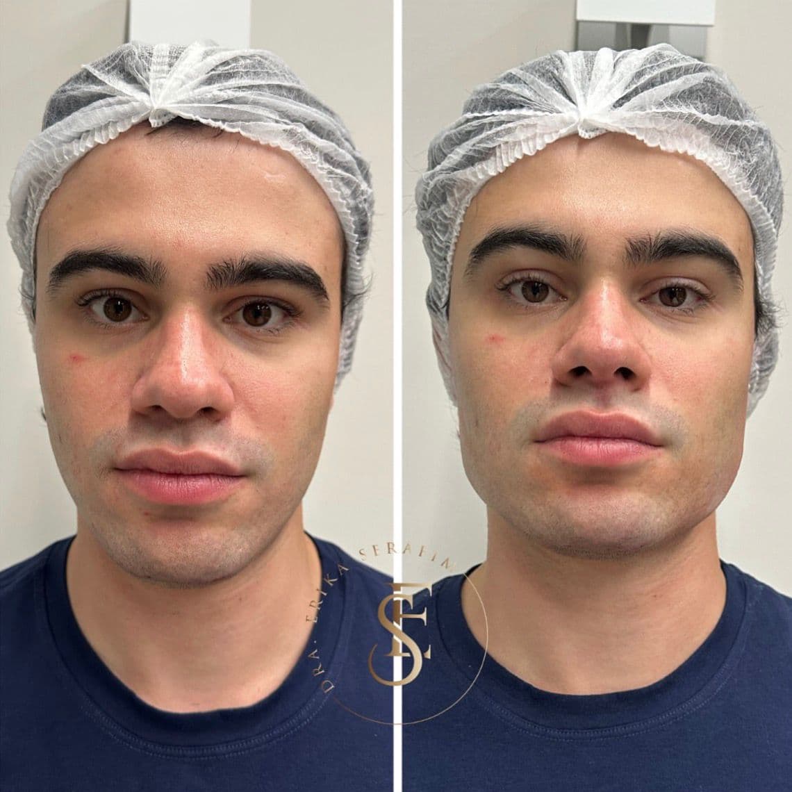 Resultado 6 — Antes e Depois