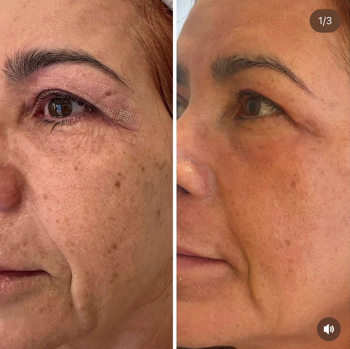 Resultado 7 — Antes e Depois